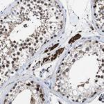 ATP Citrate Lyase Antibody in Immunohistochemistry (Paraffin) (IHC (P))
