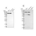 ATP Citrate Lyase Antibody in Western Blot (WB)