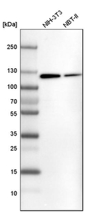 ATP Citrate Lyase Antibody in Western Blot (WB)