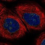 CAT1 Polyclonal Antibody