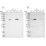 CAT1 Antibody in Western Blot (WB)