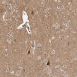 KCNIP1 Polyclonal Antibody
