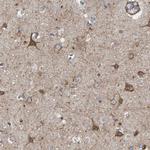 LRP1 Antibody in Immunohistochemistry (Paraffin) (IHC (P))