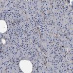 LRP1 Antibody in Immunohistochemistry (Paraffin) (IHC (P))