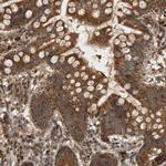 GSTK1 Antibody in Immunohistochemistry (Paraffin) (IHC (P))