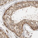 GSTK1 Antibody in Immunohistochemistry (Paraffin) (IHC (P))