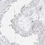 ARTS Antibody in Immunohistochemistry (Paraffin) (IHC (P))