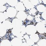 MMP8 Antibody in Immunohistochemistry (Paraffin) (IHC (P))