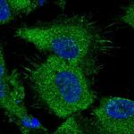 ATP Citrate Lyase Polyclonal Antibody