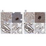 ATP Citrate Lyase Antibody in Immunohistochemistry (Paraffin) (IHC (P))
