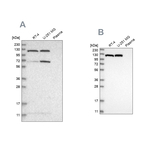 ATP Citrate Lyase Antibody in Western Blot (WB)