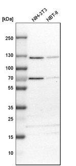 ATP Citrate Lyase Antibody in Western Blot (WB)