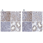 CALCOCO2 Antibody in Immunohistochemistry (Paraffin) (IHC (P))
