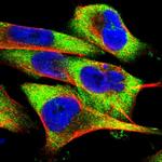 FXR2 Polyclonal Antibody