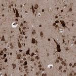 FXR2 Antibody in Immunohistochemistry (Paraffin) (IHC (P))