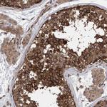 FXR2 Antibody in Immunohistochemistry (Paraffin) (IHC (P))