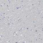 IDO Antibody in Immunohistochemistry (Paraffin) (IHC (P))