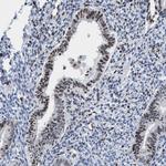 CBX2 Antibody in Immunohistochemistry (Paraffin) (IHC (P))