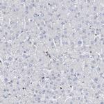 CBX2 Antibody in Immunohistochemistry (Paraffin) (IHC (P))