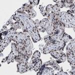 CBX2 Antibody in Immunohistochemistry (Paraffin) (IHC (P))