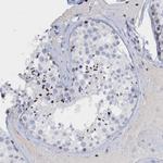 CBX2 Antibody in Immunohistochemistry (Paraffin) (IHC (P))