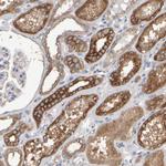 EPHX2 Antibody in Immunohistochemistry (Paraffin) (IHC (P))