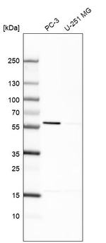 EPHX2 Antibody in Western Blot (WB)