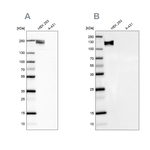 NEFM Antibody in Western Blot (WB)