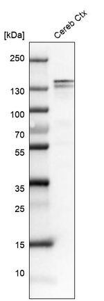 NEFM Antibody in Western Blot (WB)