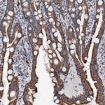 DECR1 Antibody in Immunohistochemistry (Paraffin) (IHC (P))