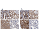 DECR1 Antibody in Immunohistochemistry (Paraffin) (IHC (P))