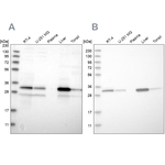 DECR1 Antibody in Western Blot (WB)