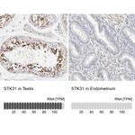 STK31 Antibody