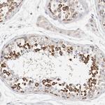 STK31 Antibody in Immunohistochemistry (Paraffin) (IHC (P))
