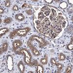 CALCOCO2 Antibody in Immunohistochemistry (Paraffin) (IHC (P))