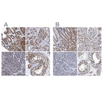 CALCOCO2 Antibody in Immunohistochemistry (Paraffin) (IHC (P))