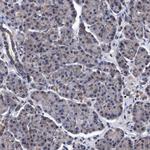 CALCOCO2 Antibody in Immunohistochemistry (Paraffin) (IHC (P))