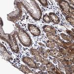 CALCOCO2 Antibody in Immunohistochemistry (Paraffin) (IHC (P))