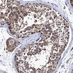 CALCOCO2 Antibody in Immunohistochemistry (Paraffin) (IHC (P))
