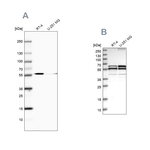 CALCOCO2 Antibody in Western Blot (WB)