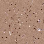 BRD9 Antibody in Immunohistochemistry (Paraffin) (IHC (P))