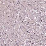 BRD9 Antibody in Immunohistochemistry (Paraffin) (IHC (P))
