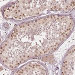 BRD9 Polyclonal Antibody