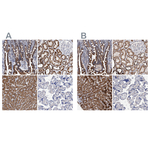 DECR1 Polyclonal Antibody