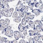 DECR1 Antibody in Immunohistochemistry (Paraffin) (IHC (P))