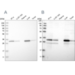DECR1 Antibody in Western Blot (WB)