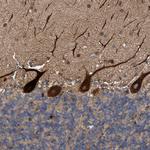 C8orf55 Antibody in Immunohistochemistry (Paraffin) (IHC (P))