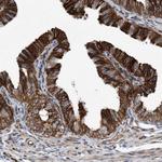 C8orf55 Antibody in Immunohistochemistry (Paraffin) (IHC (P))