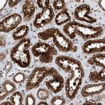 C8orf55 Antibody in Immunohistochemistry (Paraffin) (IHC (P))