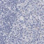 CTH Antibody in Immunohistochemistry (Paraffin) (IHC (P))